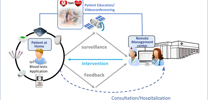 Remote monitoring network Remote monitoring network of the Bordeaux University Hospital